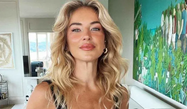 Tatilden bikinili kareler! Burcu Esmersoy’un kaplumbağalı pozları ilgi çekti