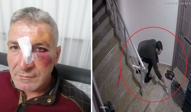 Dairesinin önüne hayvan dışkısı atan komşusundan, bu kez 'yüzüne kapı çarptığı' için şikayetçi oldu