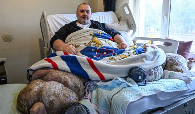 30 kişi tarafından evinden çıkarılan fil hastası, Ankara'ya götürüldü