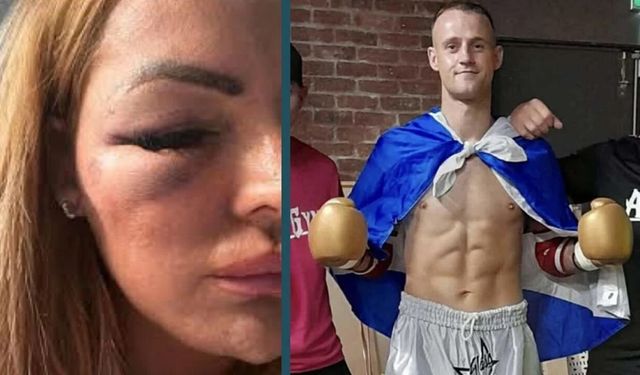 Kendisini reddeden kadını hastanelik etti!