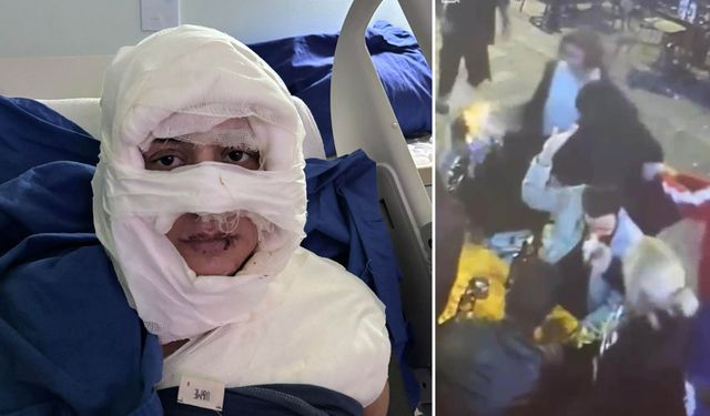 Üzerine kolonya dökerek kadını yakan zanlı: 'Bilincim yerinde değildi!'