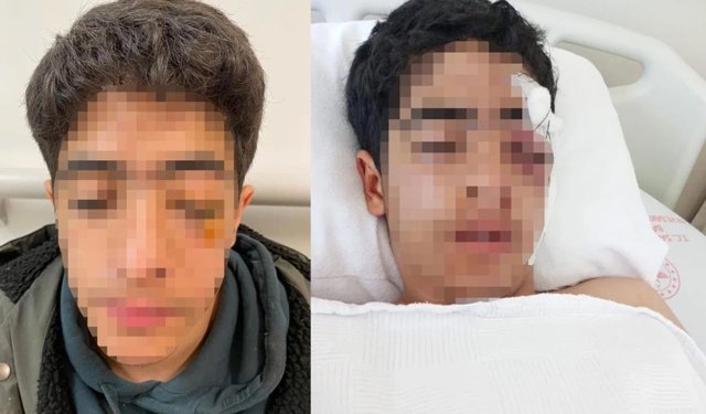 İstanbul'da akran zorbalığı: 15 yaşındaki çocuğa muştalı saldırı