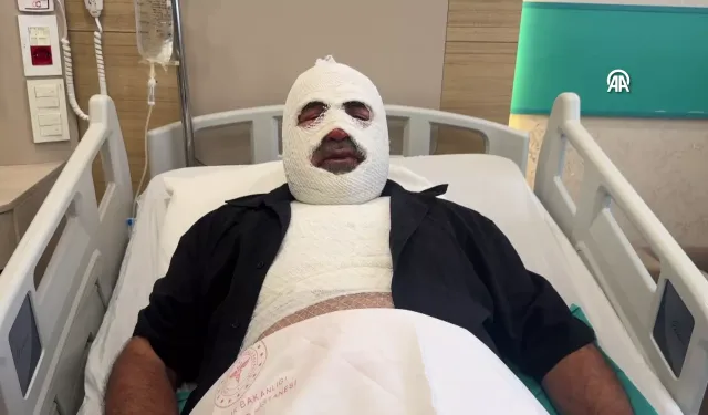 Hararet yapan araca soğumadan müdahale etti, ağır yaralandı