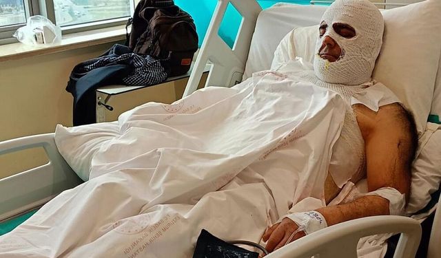 Yüksek gerilim akımına kapılan işçi 42 gündür hastanede
