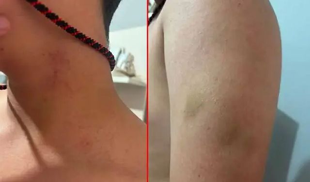 Öğretmen, öğrencisini 'neden gülüyorsun' diyerek darbetti