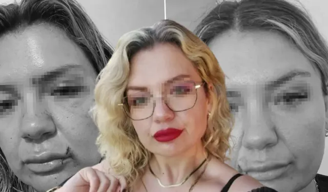 Cezaevinden izinli çıkıp dehşeti yaşattı: Bıçak kadının sırtında kırıldı!