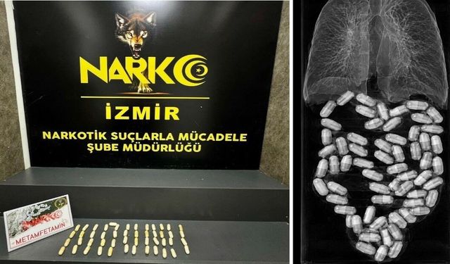 Midesinden 50 kapsül uyuşturucu çıktı; tutuklandı