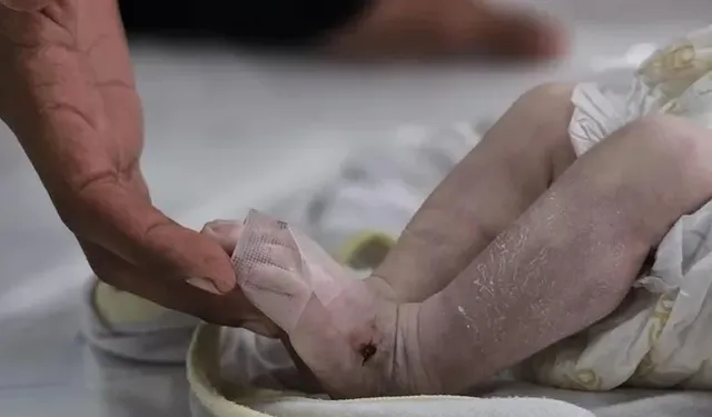 18 aylık bebek kalbi atmasına rağmen morgda bırakıldı!