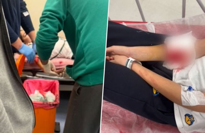 Ankara'daki bir özel okulda, öğrencinin koluna kapı kolu saplandı!