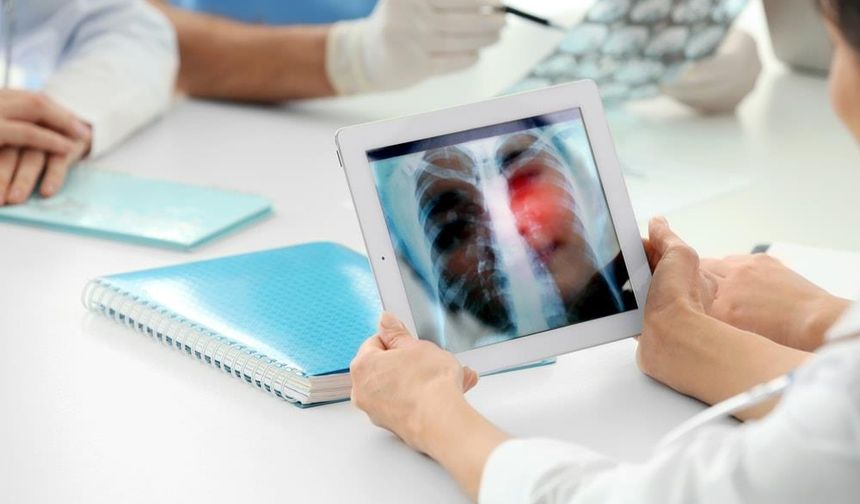 Akciğer kanserinde erken teşhis hayat kurtarıyor