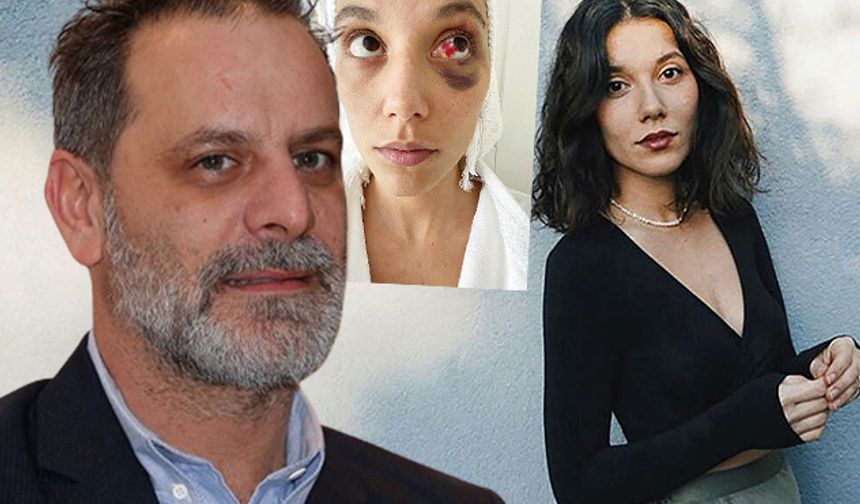 Eski sevgilisine şiddet uygulayan Ozan Güven’e hapis cezası