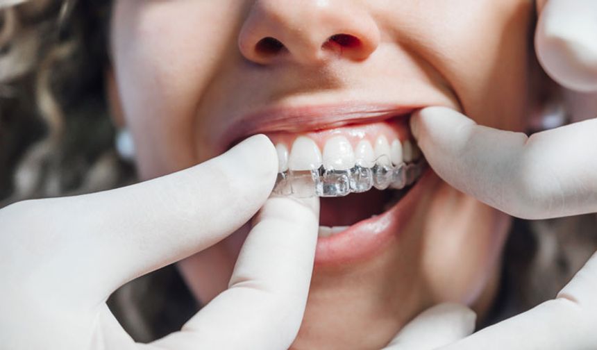 Diş tedavisinde estetik kaygılar nedeniyle 'şeffaf plak' uygulamaları tercih ediliyor