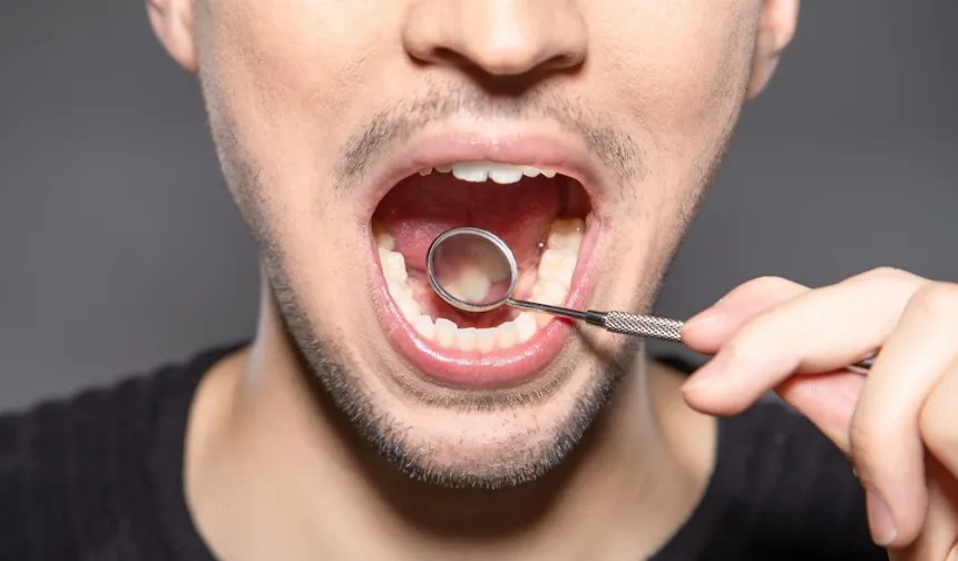 Diş minesini onaran yeni jel: Çürüklerin sonu mu geliyor?