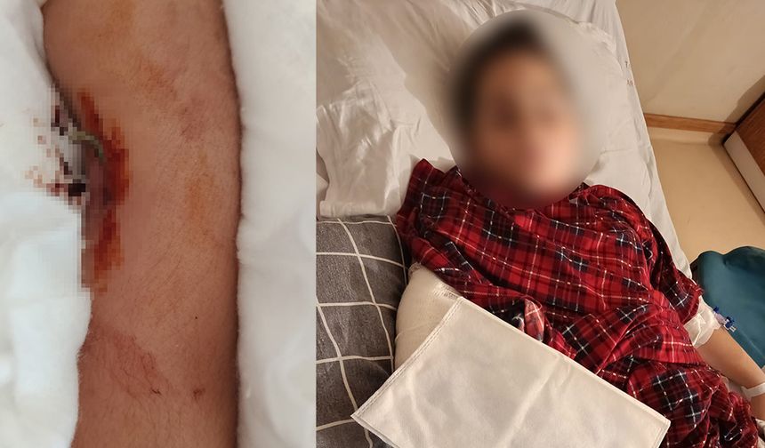 İstanbul'da akran zorbalığı: Arkadaşının kolunu 2 yerden kırdı