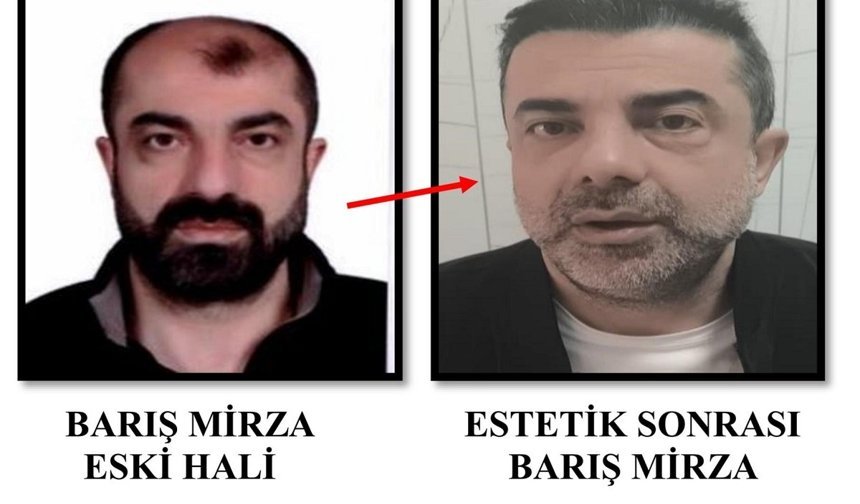 Cinayete azmettirmekten aranan ve yüzünü değiştiren kişi tutuklandı
