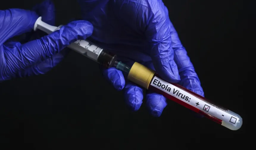 DSÖ'den Ebola virüsüyle ilgili kritik uyarı!