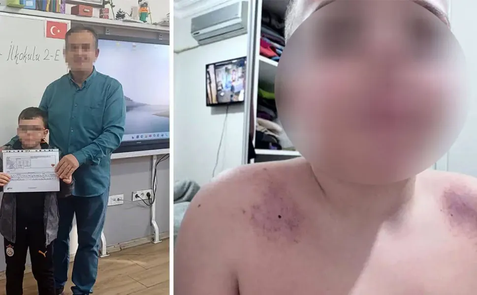 Öğretmen 8 yaşındaki çocuğu darp etti iddiası: Aile şikayetçi oldu!