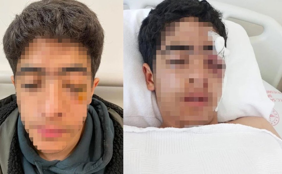 İstanbul'da akran zorbalığı: 15 yaşındaki çocuğa muştalı saldırı
