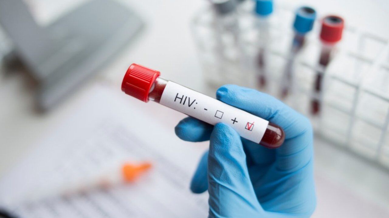 Türkiye’de HIV vakaları arttı: Haftada 2-3 hasta geliyor!