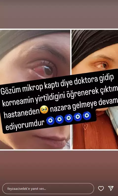 Feyza Civelek Korneası Yırtıldı