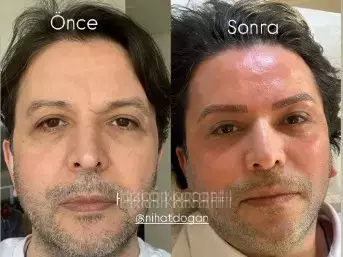 Nihat Doğan Estetik