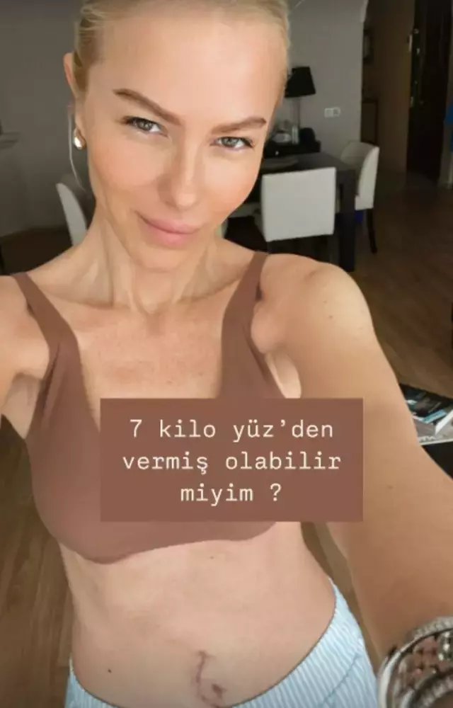 Seçil Gür Sağlık Sorunu