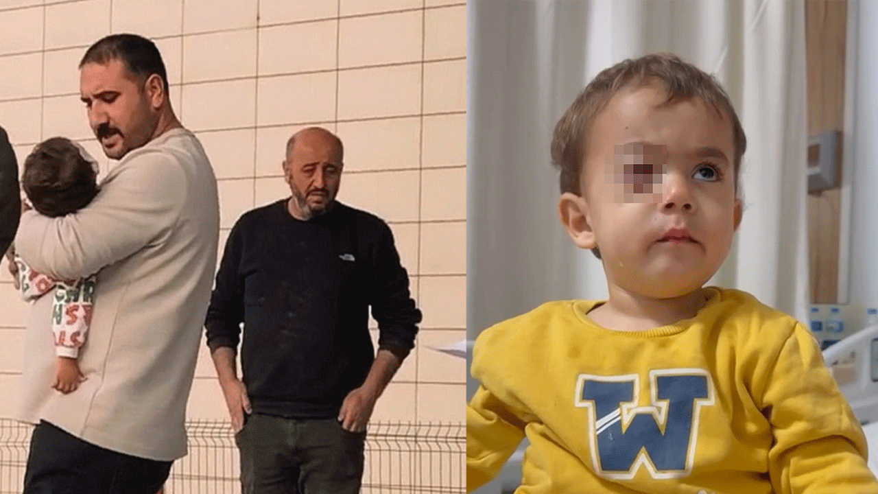 Bursa'da, 2 yaşındaki Alpaslan'ın görme yetisini kaybetmesine neden olan torpil, fırından alınmış