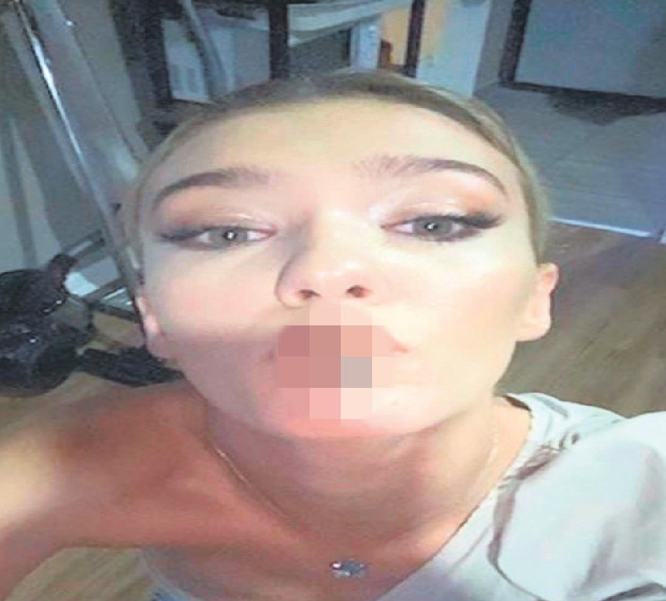 Melisa Döngel Kok No Lazım Acil Kanka