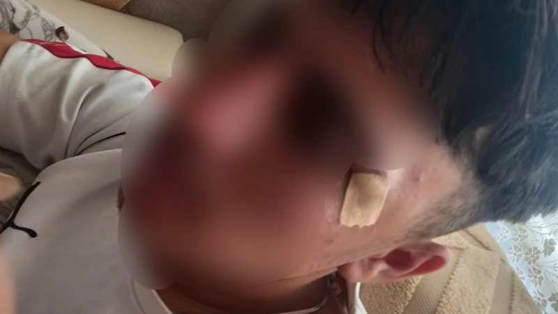 Afyonkarahisar'da öğretmenin kafa attığı çocuğun burnu kırıldı